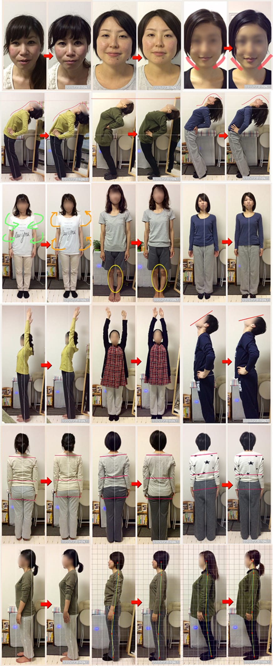 整体ビフォー・アフターの画像