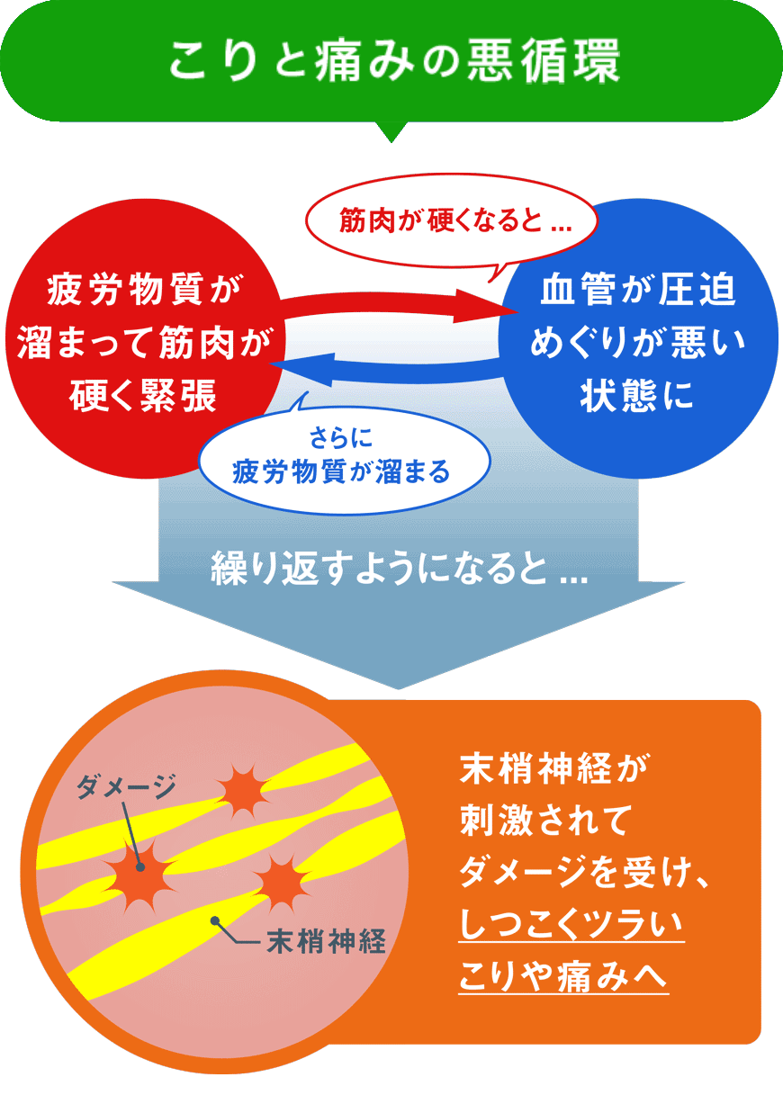 首こりと痛みの悪循環